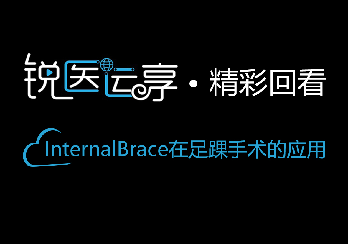 【精彩回看】InternalBrace在足踝手术的应用