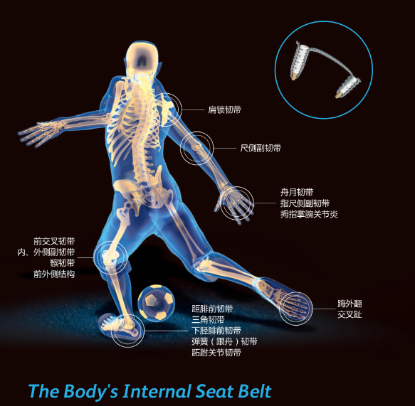 InternalBrace术式包——足踝篇