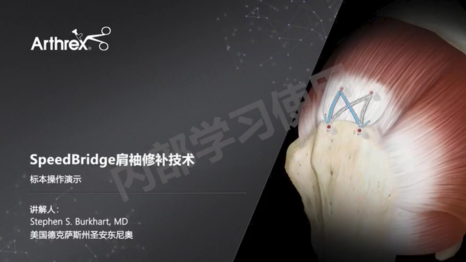 标本操作演示-SpeedBridge 修复技术